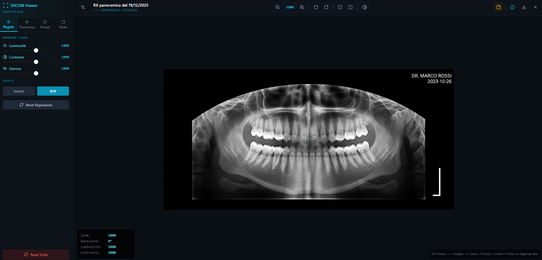 DICOM Viewer Radiografia Panoramica